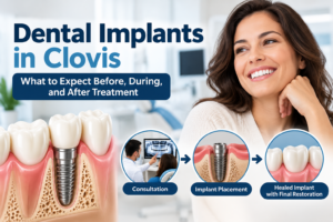 Dental Implants in Clovis